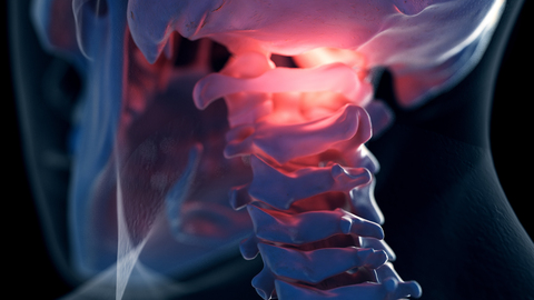 Cranio-cervical Stability Testing for Manual Clinicians: A Definitive Guide